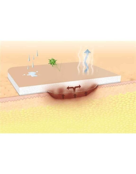 SUPRASORB P NO ADHESIVO-2-900×1150