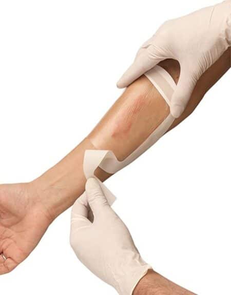 a person with a wound on their arm y apósito film transparente